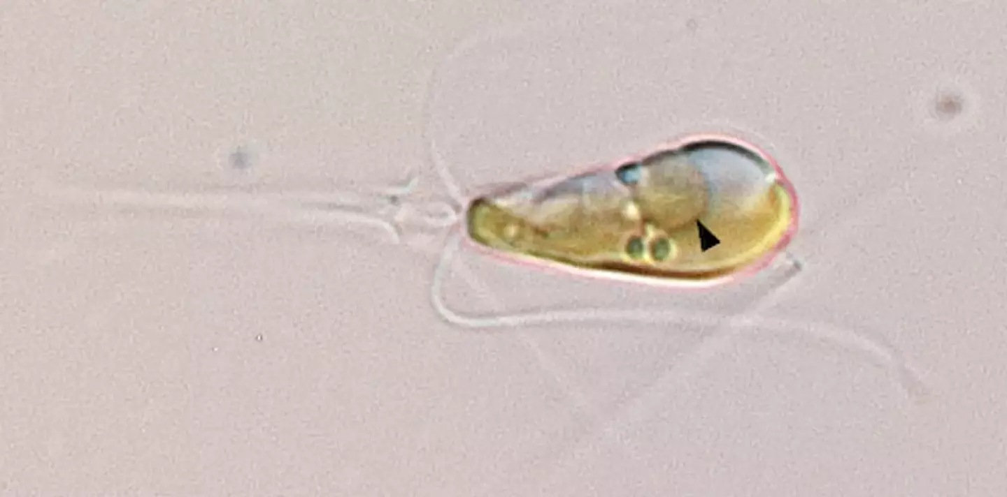 This is the micro-organism in question. (UCSC/Tyler Coale / Hagino et al, PLOS ONE 2013)