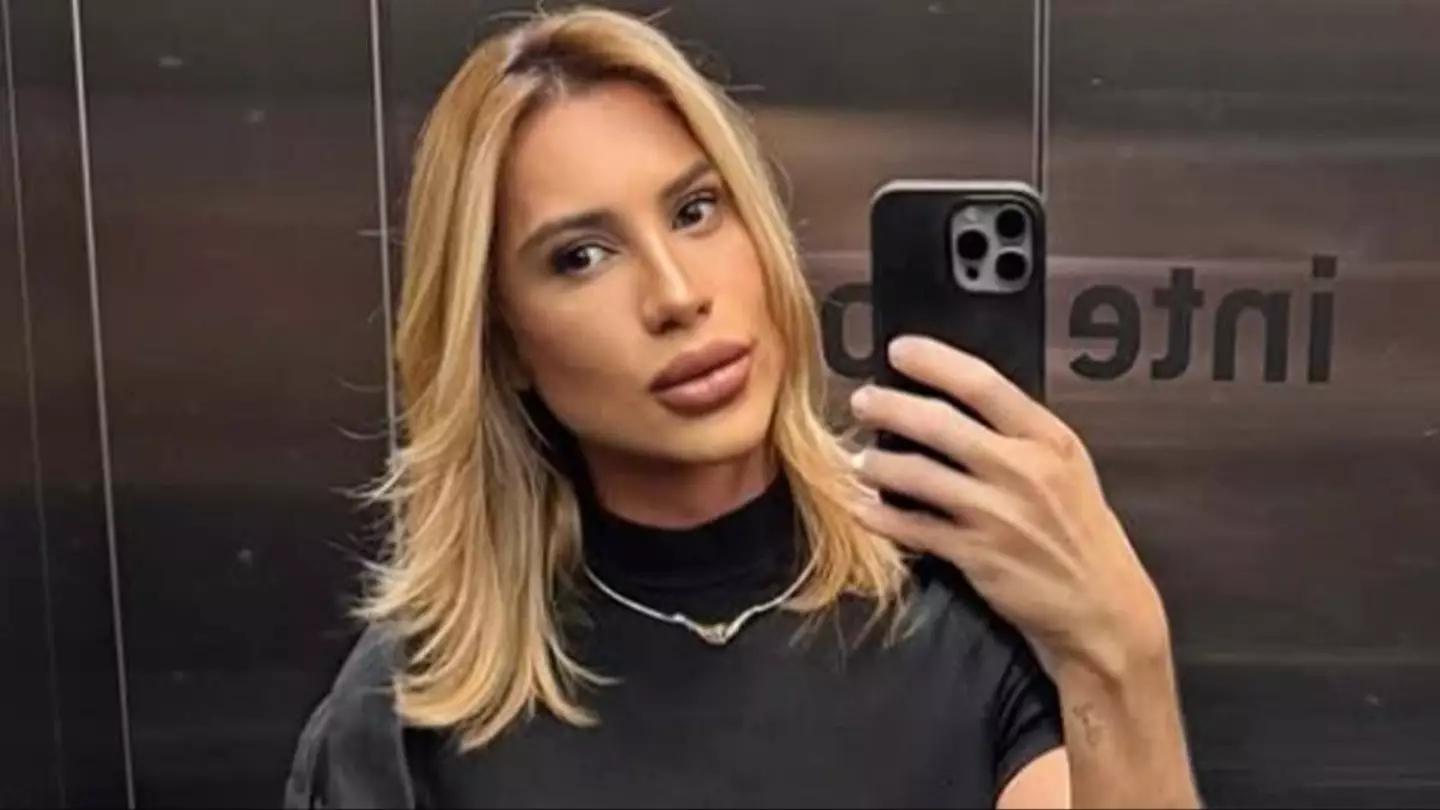 Influencer dies after complaining about complications from popular 'Fox Eyes' surgery