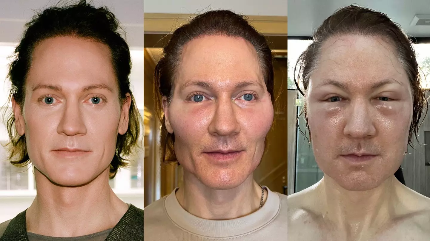 The biohacker suffered an allergic reaction (Twitter/@bryan_johnson)