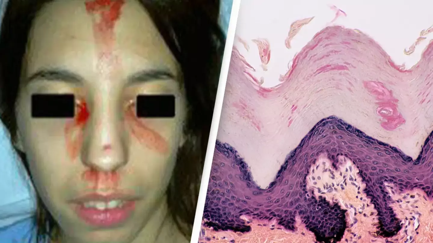 Woman who began sweating blood from her face and palms was later diagnosed with rare medical condition