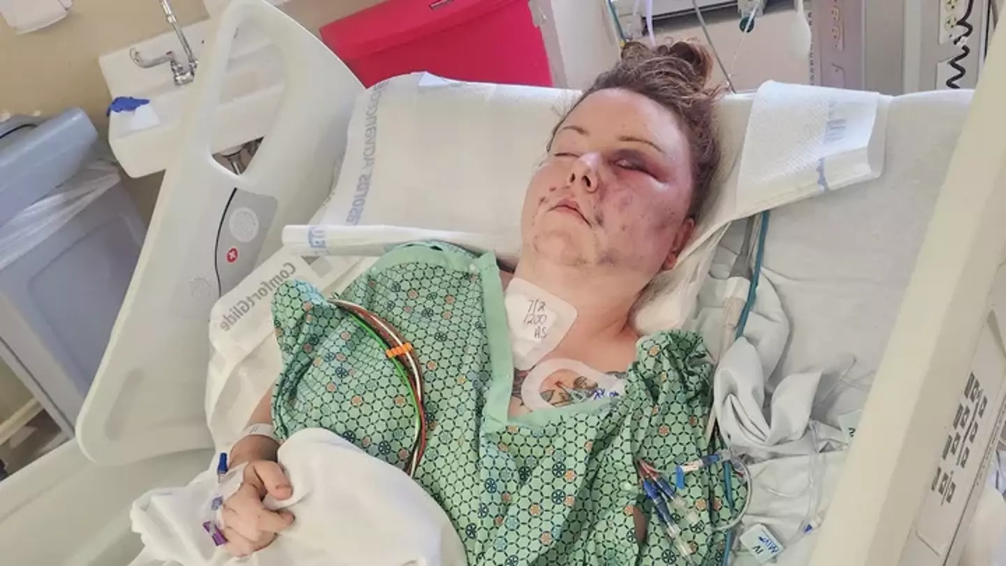 Tessa Mowel was allegedly attacked by her husband (GoFundMe)