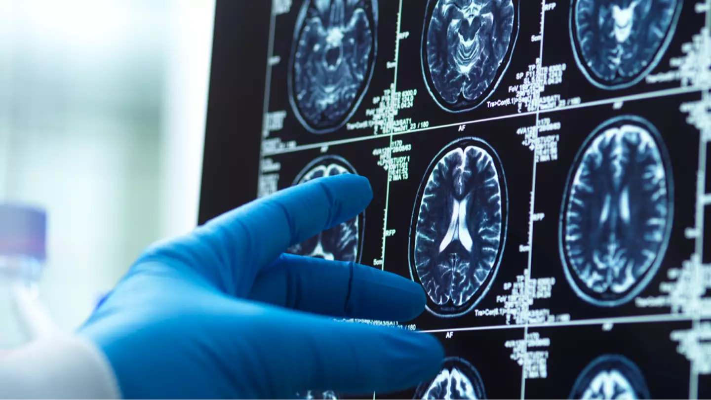 Research shows the age our brains actually peak and it will surprise you