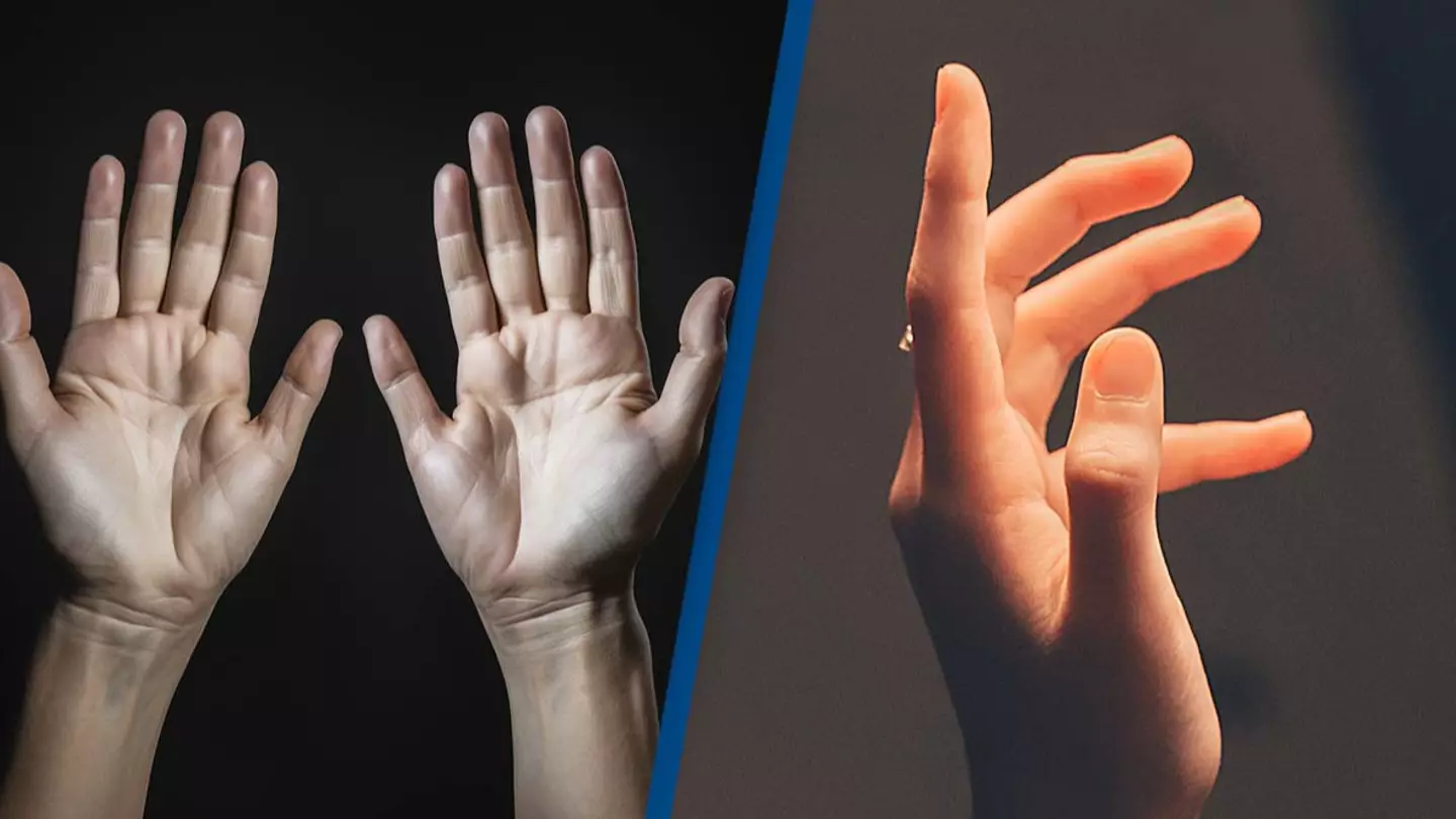 AI's creation of 'a normal pair of human hands' has people seriously confused