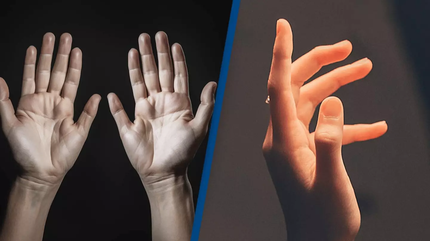 AI's creation of 'a normal pair of human hands' has people seriously ...