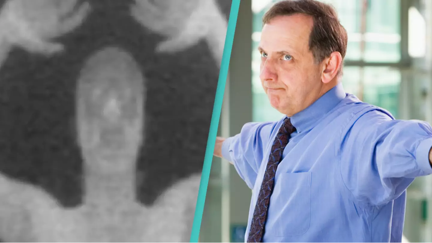 Airports forced to make change to X-ray machines after horror over what they were able to actually see