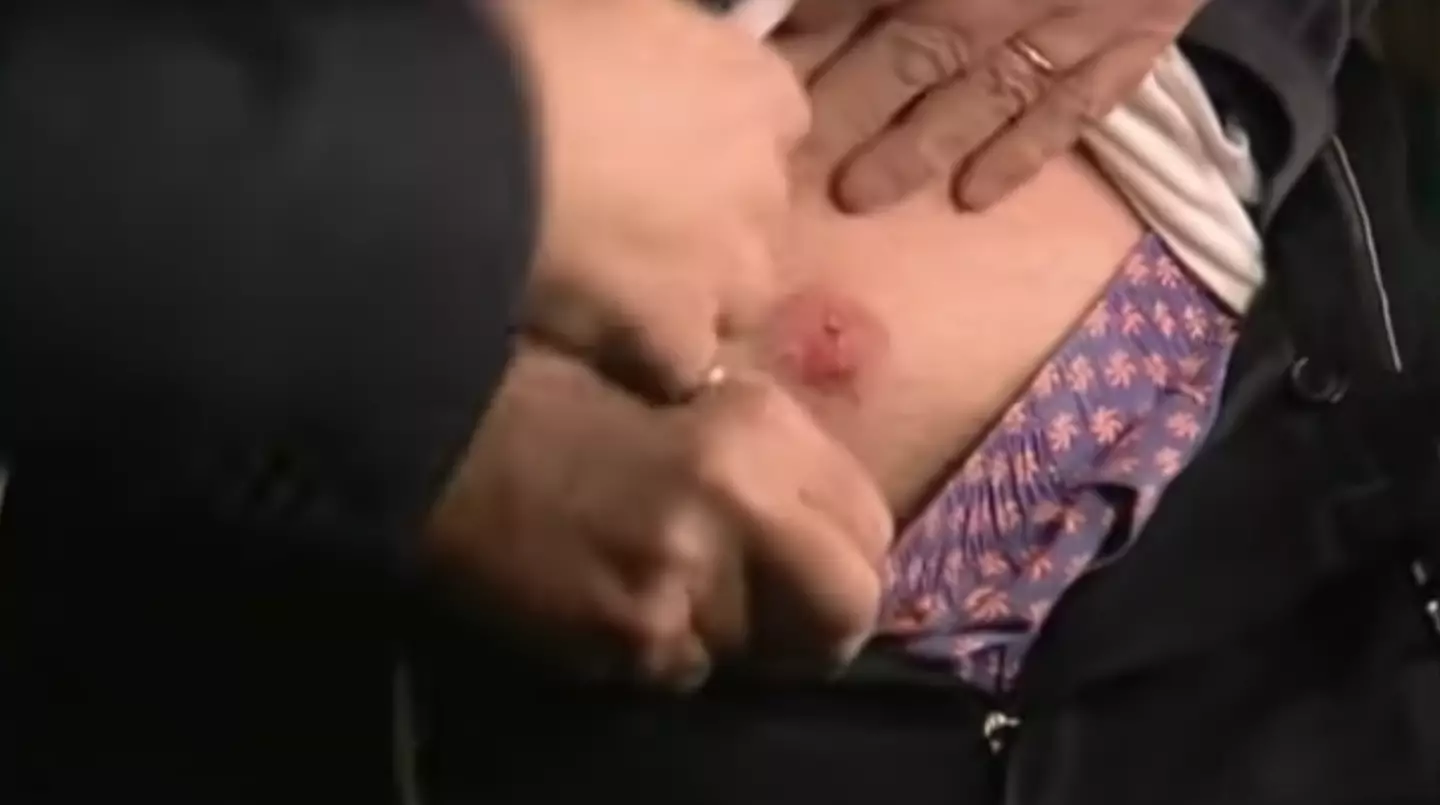 Werner Herzog was left bleeding after being shot.