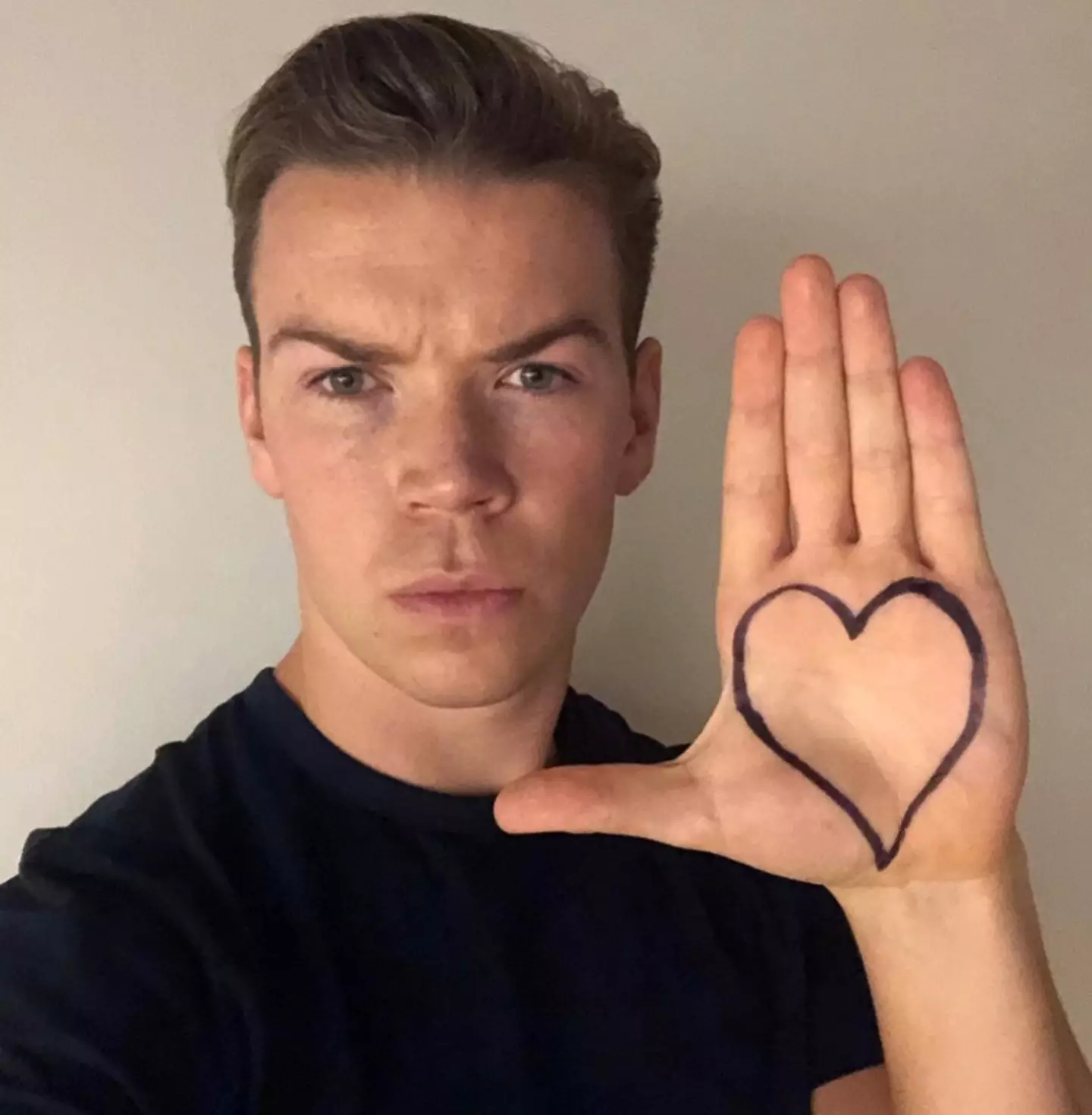 The We're the Millers actor has opened up on what it's like to have 'dyspraxia' and the misconceptions people have around developmental co-ordination disorder (DCD).