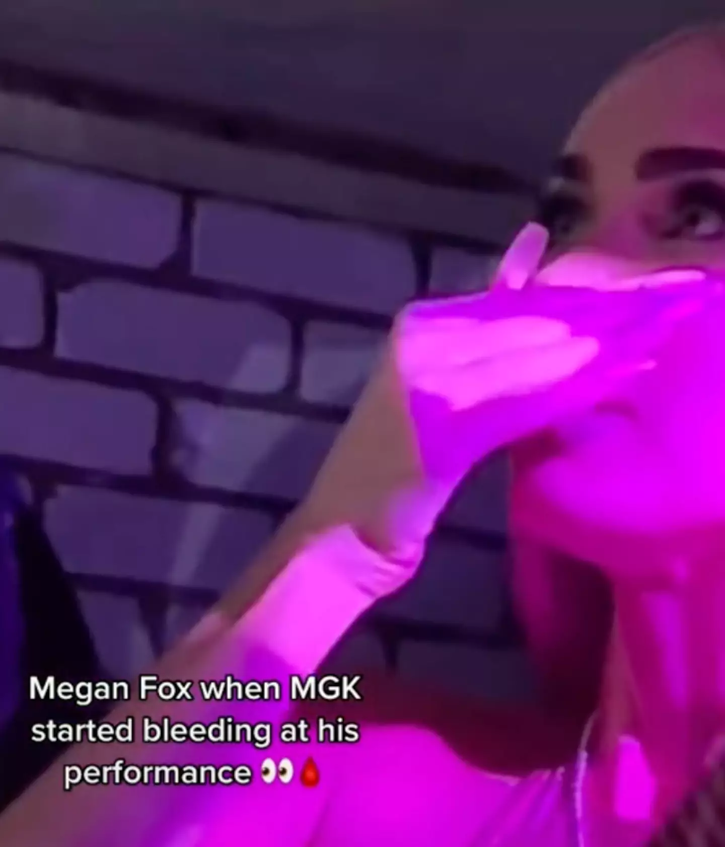 Fox looked seriously concerned when the moment unfolded.