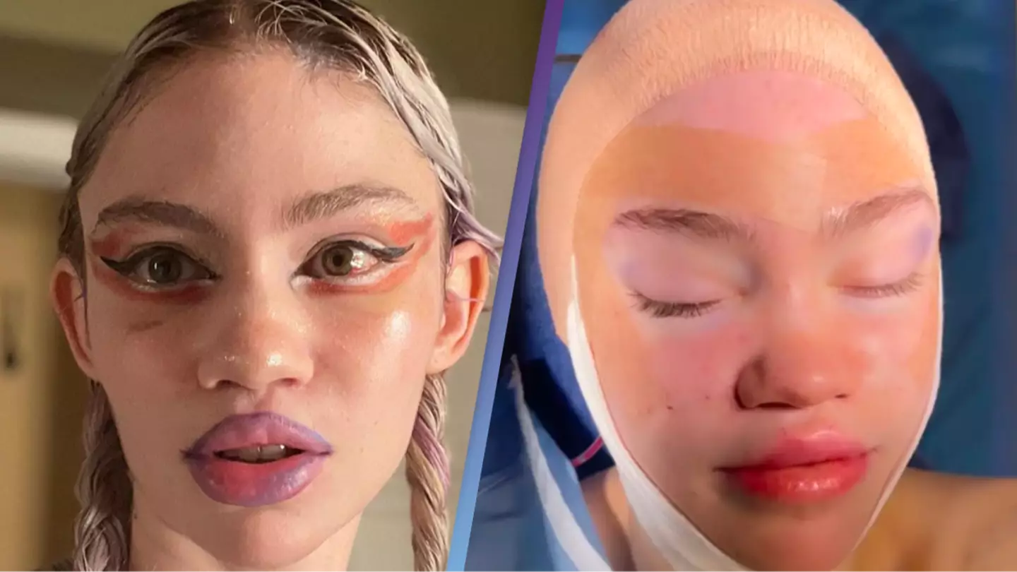 Grimes posts selfie for the first time after surgery and fans seem concerned