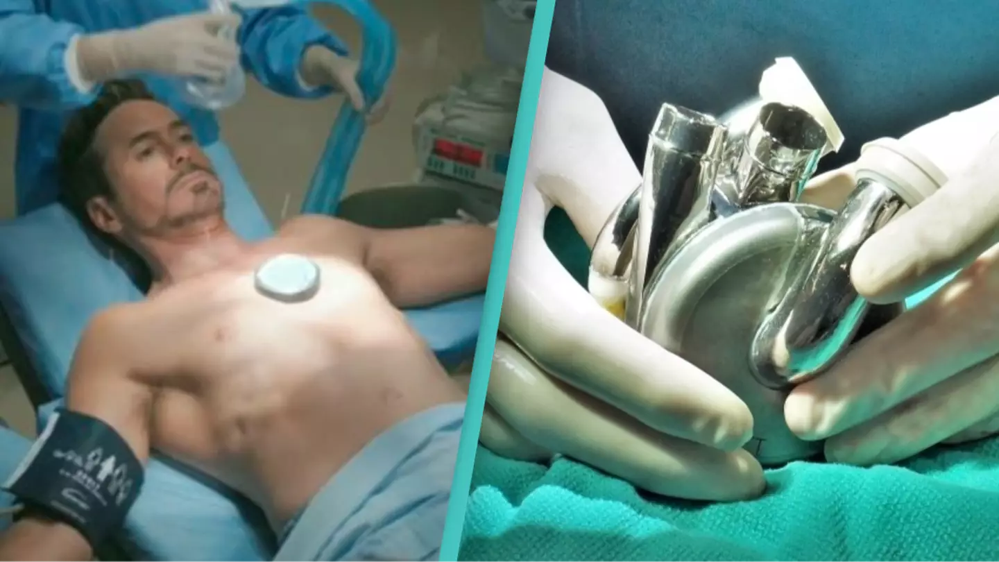 Doctors make medical breakthrough with successful transplant of a fully mechanical heart inside a human