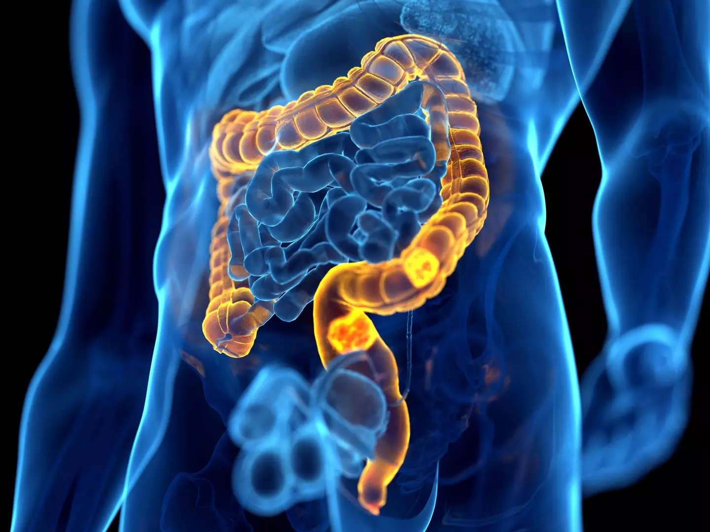 The vitamin could help reduce the risk of colorectal cancer (Getty Stock Photo)