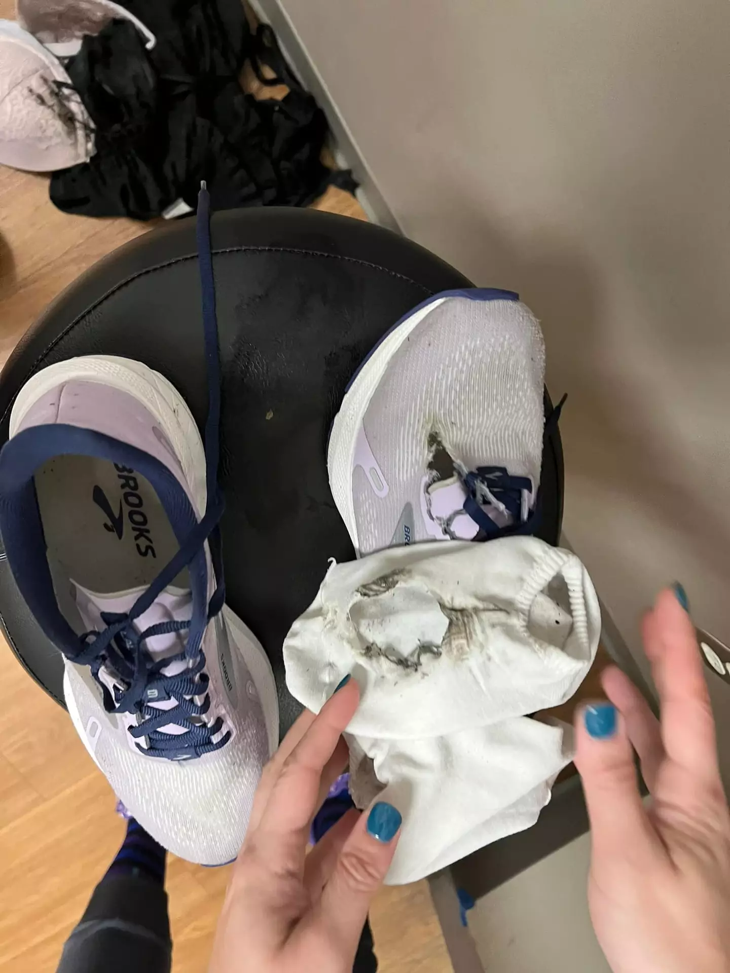 The lightning tore a hole through one of Emma's socks and shoes.