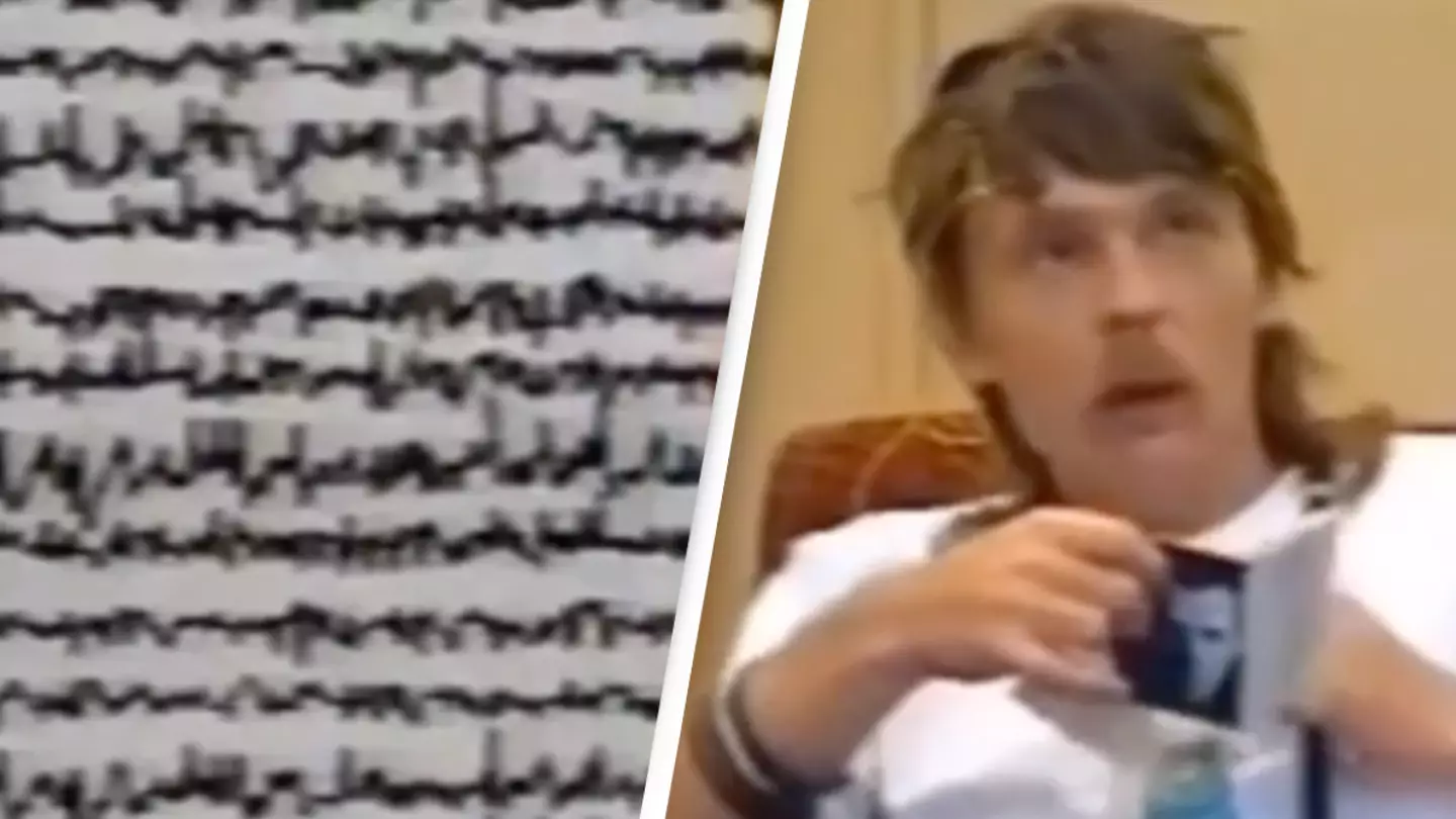 'Crazy' video shows the brainwaves of someone experiencing an epileptic seizure