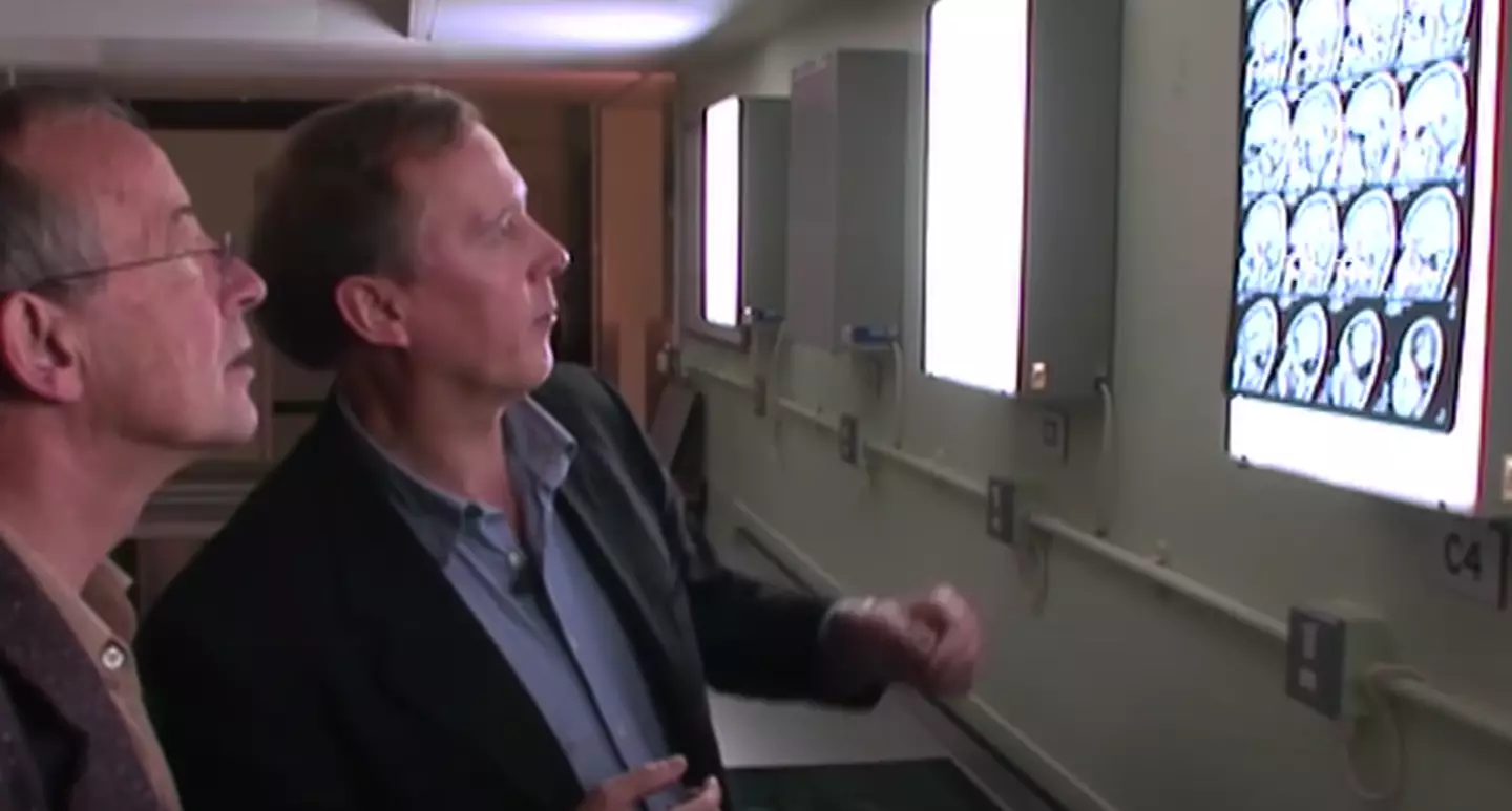 The genetics of the family and scans of the affected children's brains were used to try and solve the mystery of why they walked on all fours.