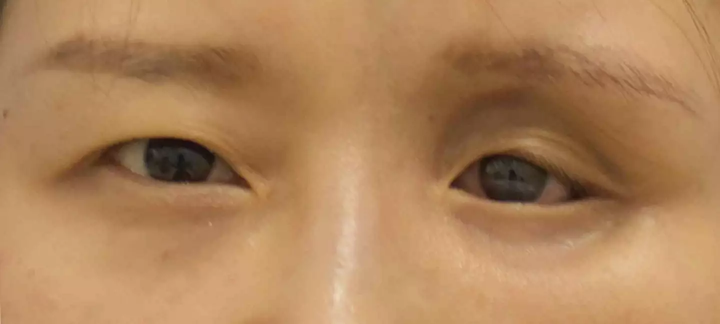 The woman initially went to the doctors to enquire about plastic surgery for an unrelated issue(Plastic and Reconstructive Surgery)