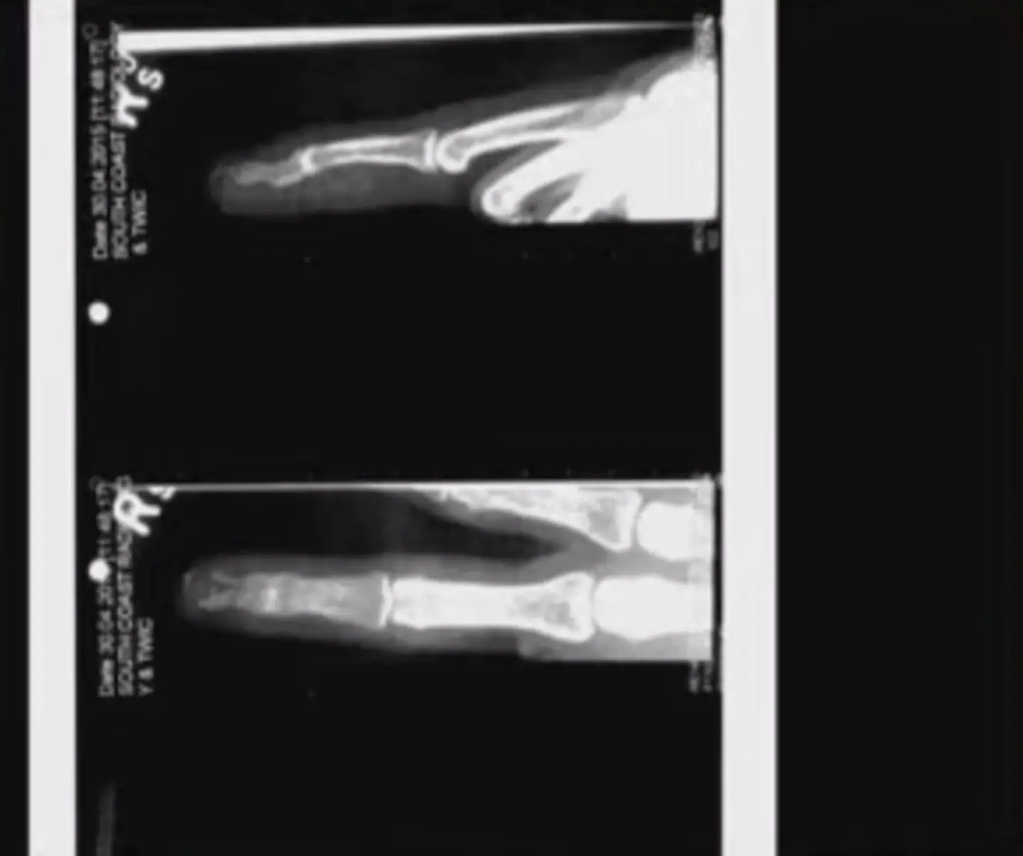 Johnny Depp's finger.