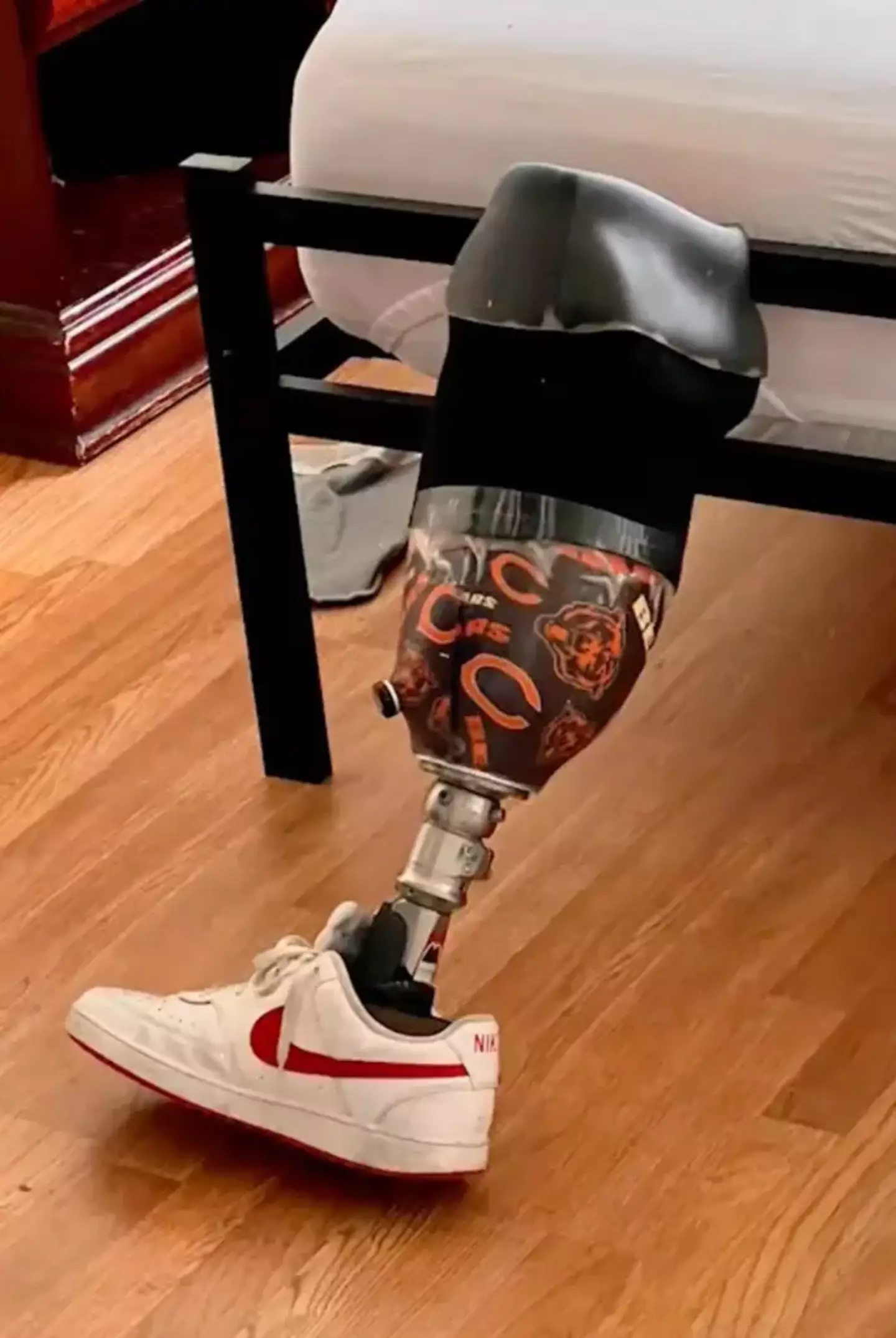 The prosthetic leg is thought to be worth just over $26,000.