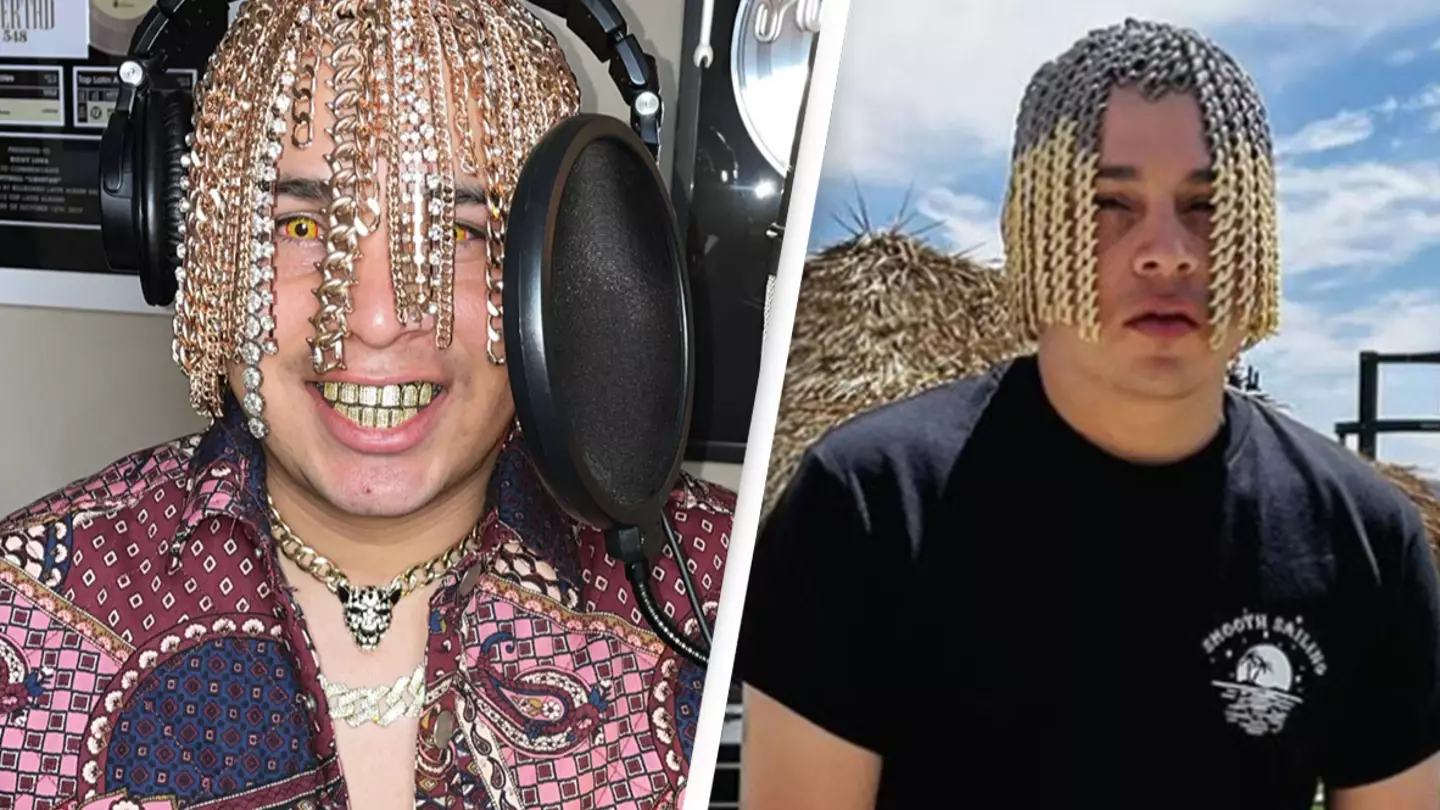 Rapper faces serious risks after having gold chains surgically 'implanted into his head' to resemble hair