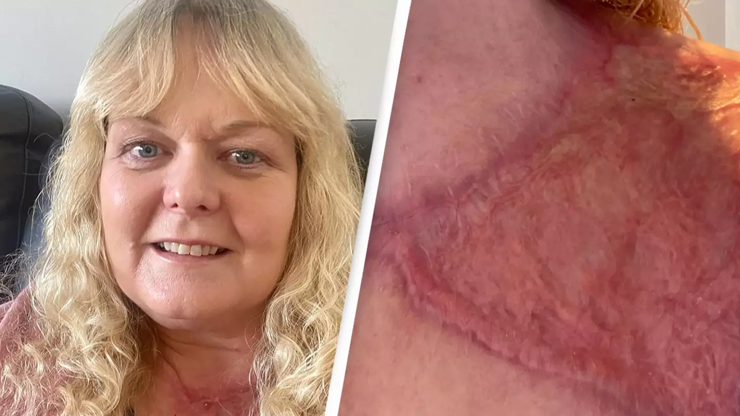 Flesh-eating bacteria left woman needing 15 surgeries and learning to walk again