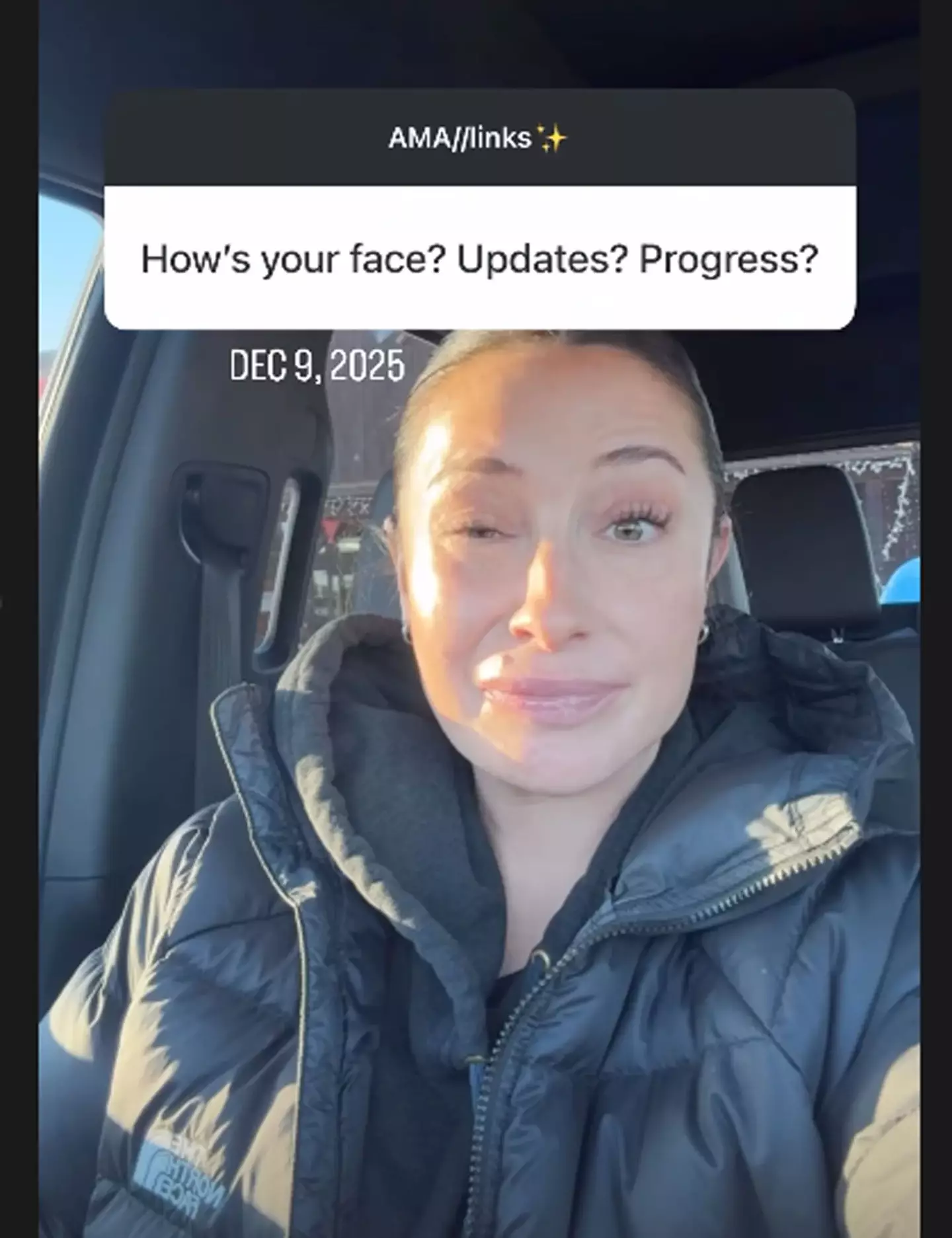 Palin shared a health update on Instagram (Instagram/@bsmp)