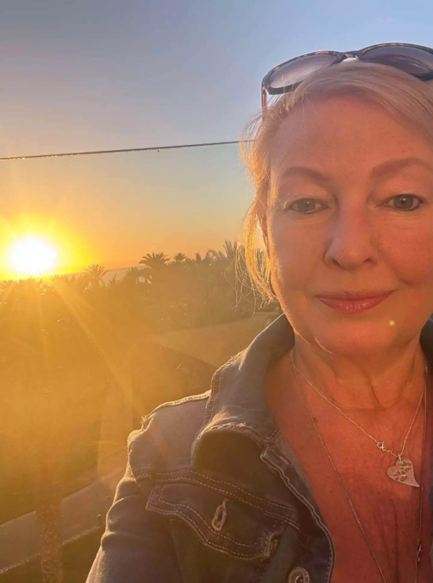 Yvonne Ford died after being diagnosed with rabies (GoFundMe)