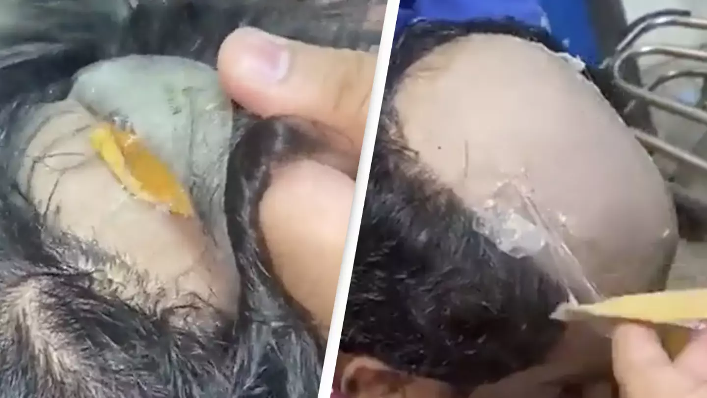Man Busted With $40,000 Worth Of Gold Hidden Under His Wig And Up His Bum