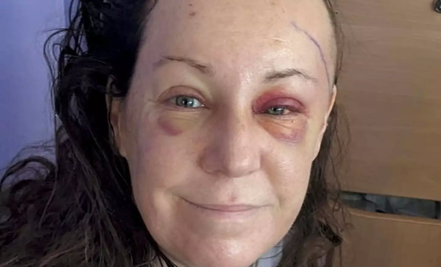 Gemma Hillier struggled to identify any words in her eye exam and sparked concerns(SWNS)
