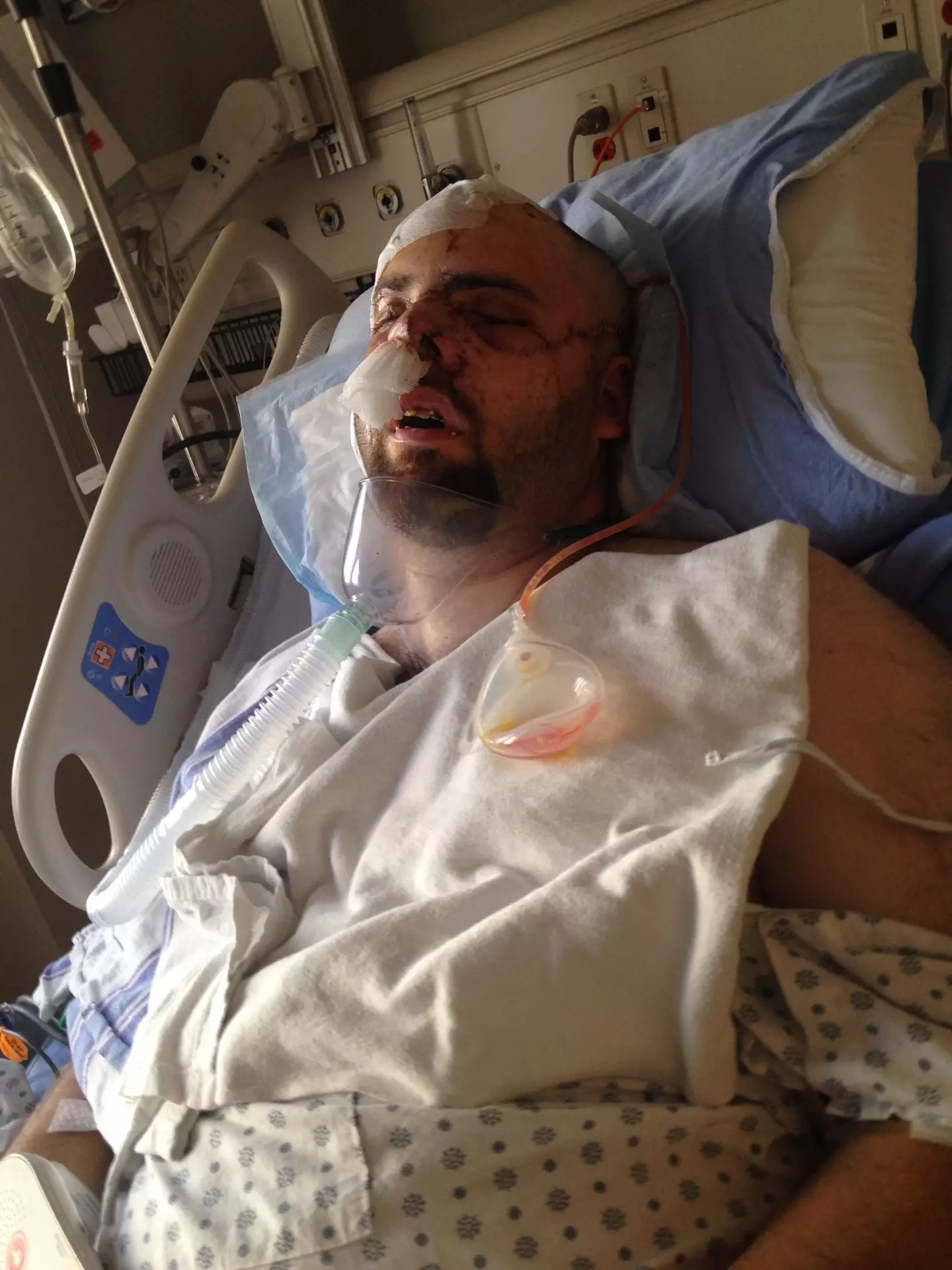 Jeremy's face had been almost entirely ripped away.