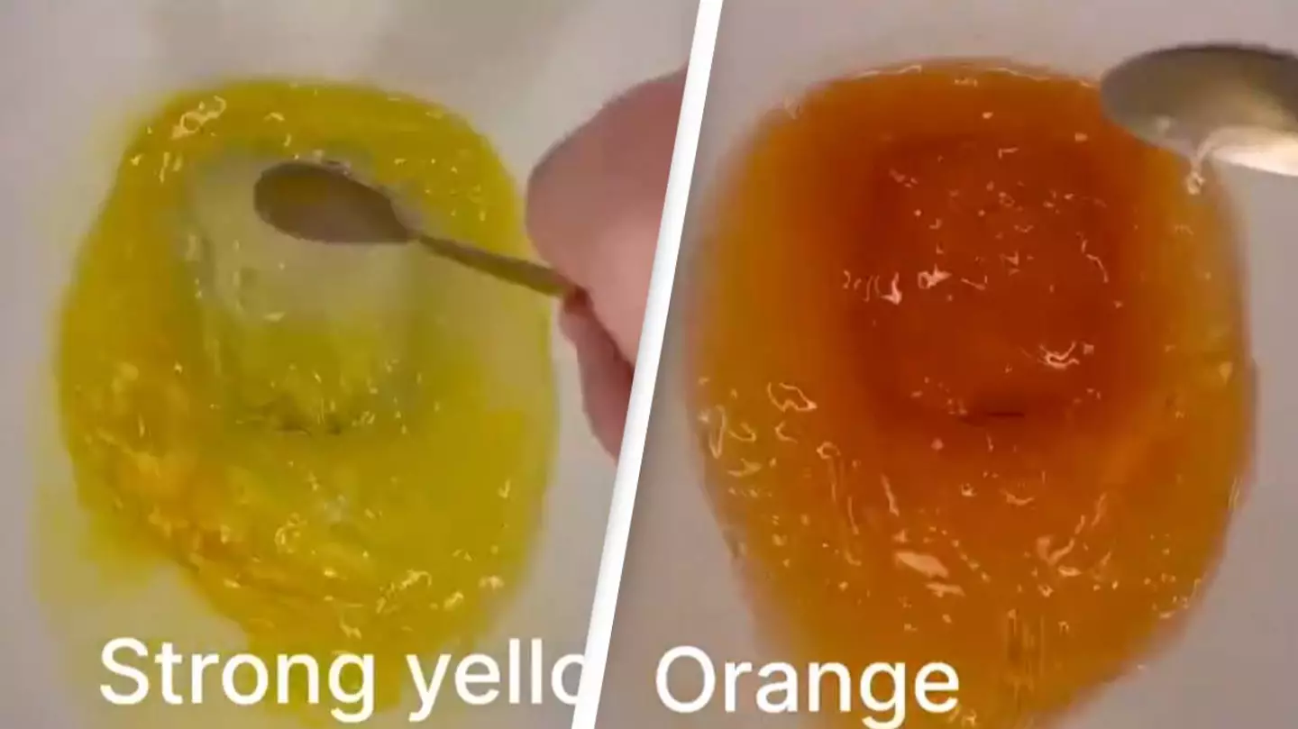 Video 'guide' explains what the color of your urine says about your health and when to be concerned