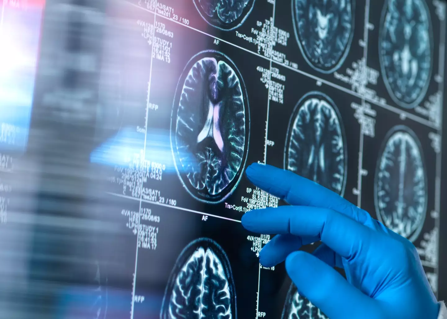 You can do these tests easily at home (Getty Stock Photo)