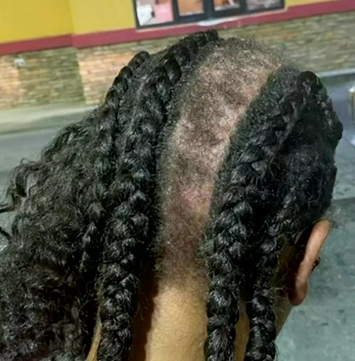 One of Dawson's braids was allegedly ripped out in the ordeal.