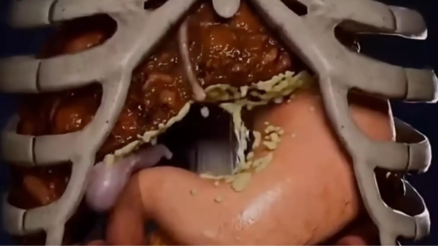 Experts issue warning about dry fasting as simulation shows what happens to your organs when you fast for 36 hours
