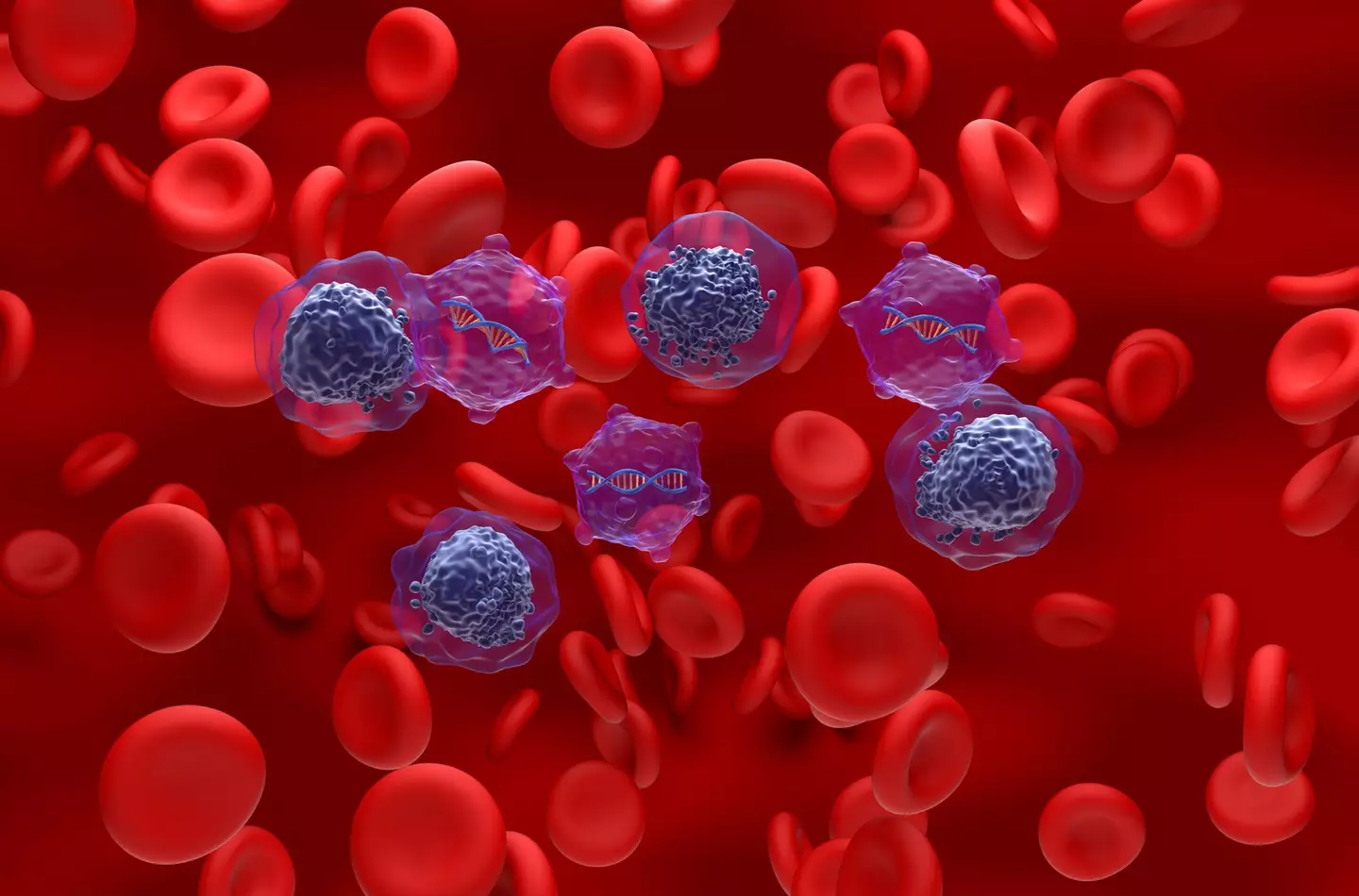 Some 20,000 new cases of AML are diagnosed every year in the US (Nemes Lazlo/Getty Images)