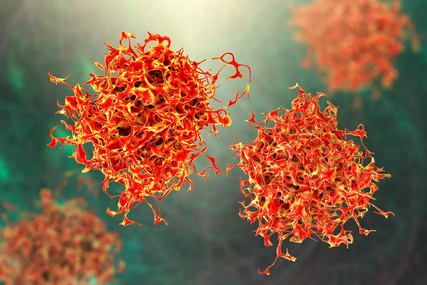 The study could change the way cancer is treated (Getty Stock Photo)