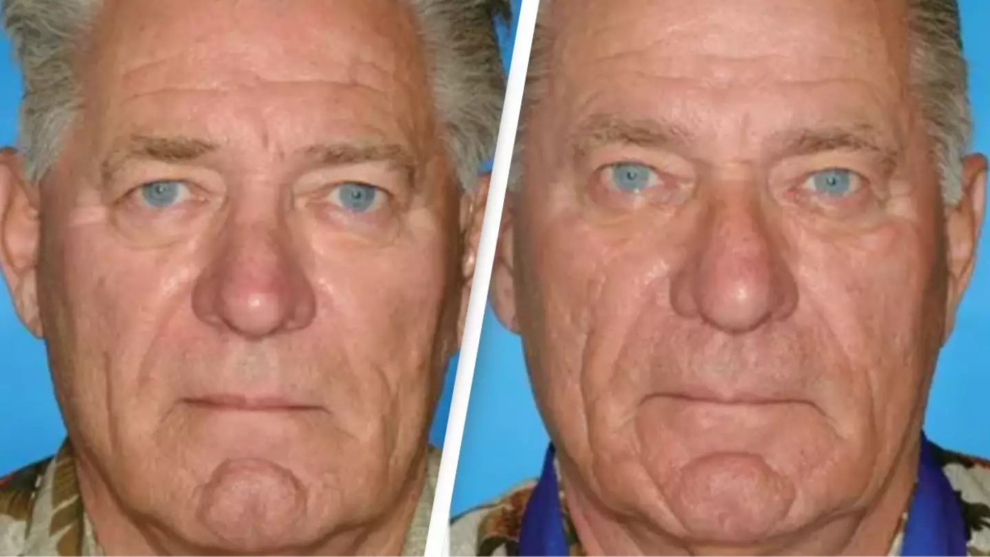 American Society of Plastic Surgeons