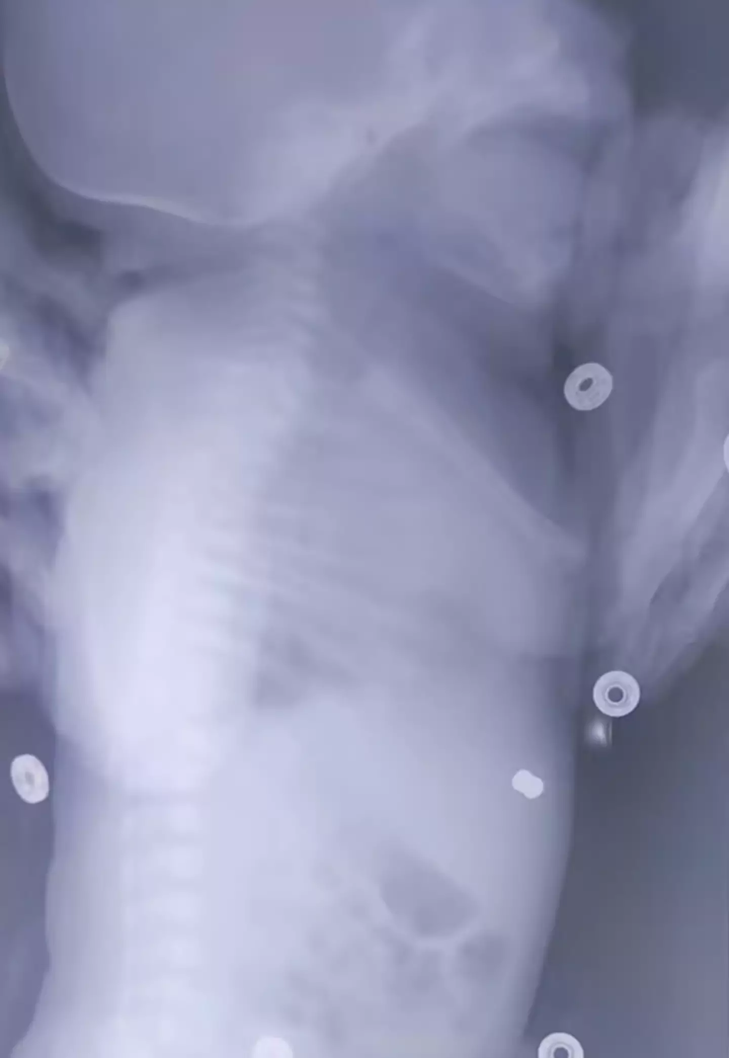 The x-ray shows the pellet in the baby's body. (Newsflash)