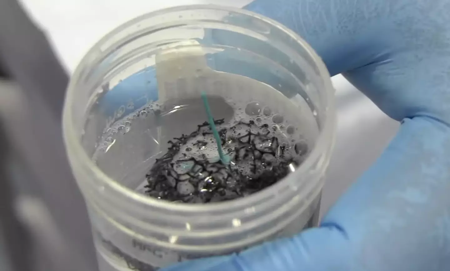 A straight forward sponge test could help diagnose a rare type of cancer (Cancer Research UK/YouTube)