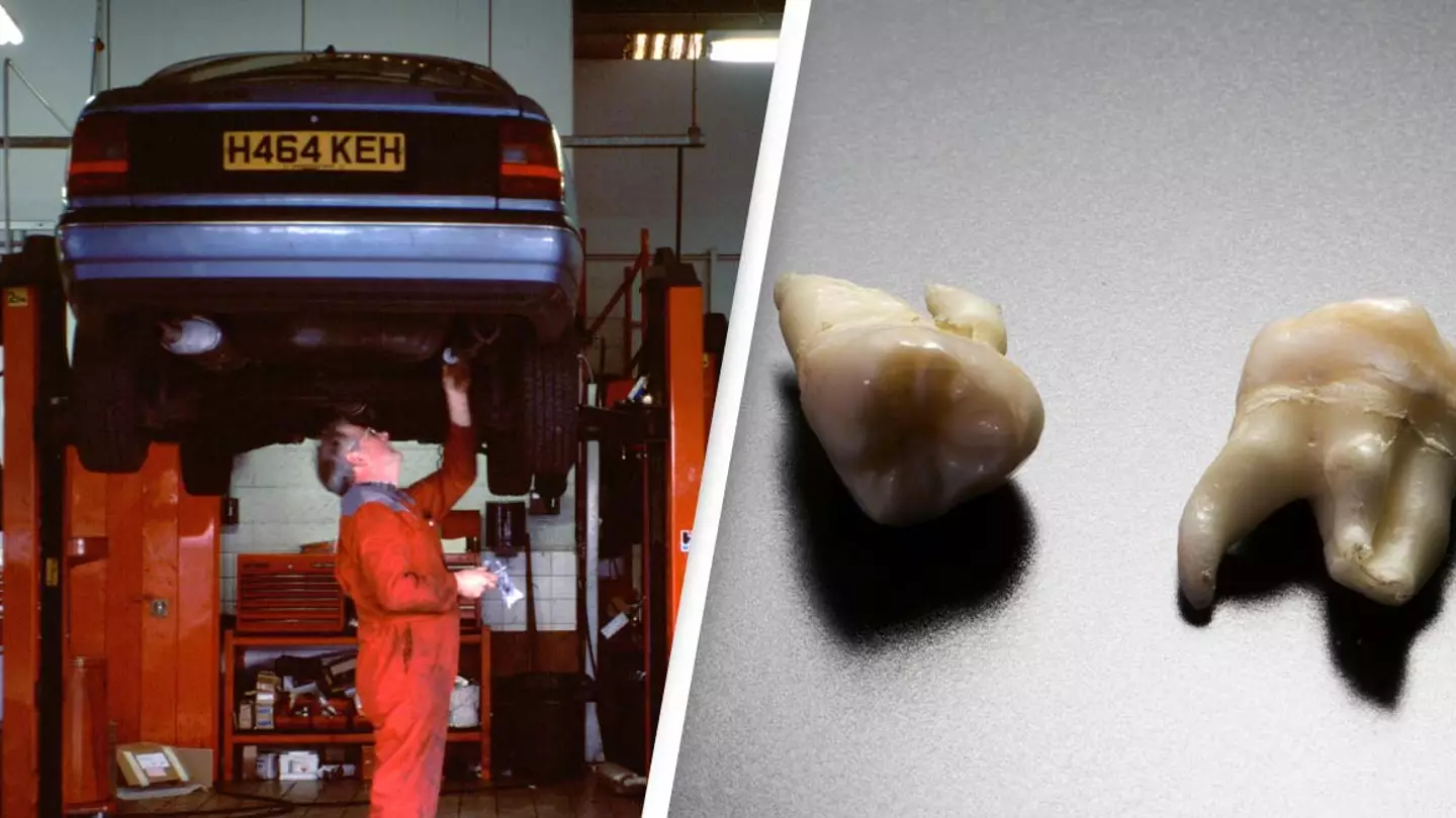 Human Teeth Discovered In Car Grill Sparks Investigation