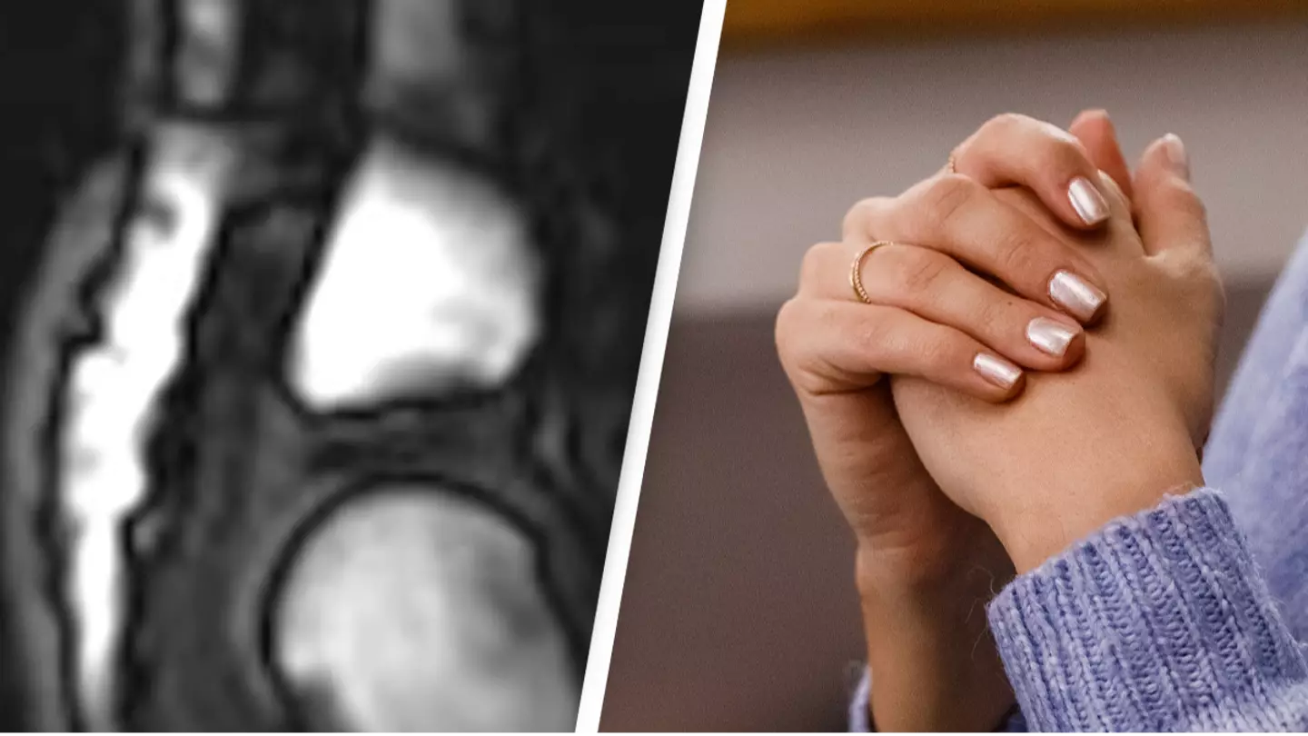 People are just learning what actually happens when you crack your knuckles