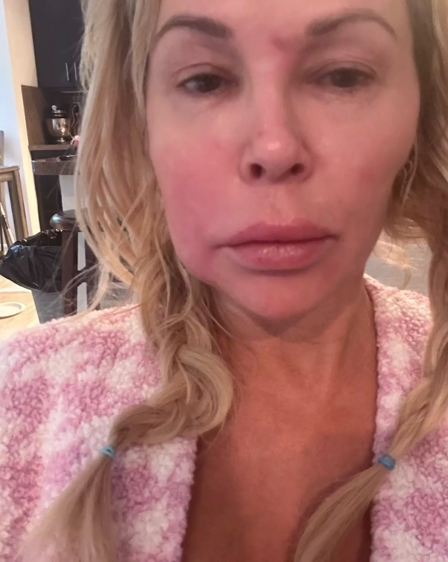 Glanville has been candid about her health issues (Instagram/@brandiglanville)
