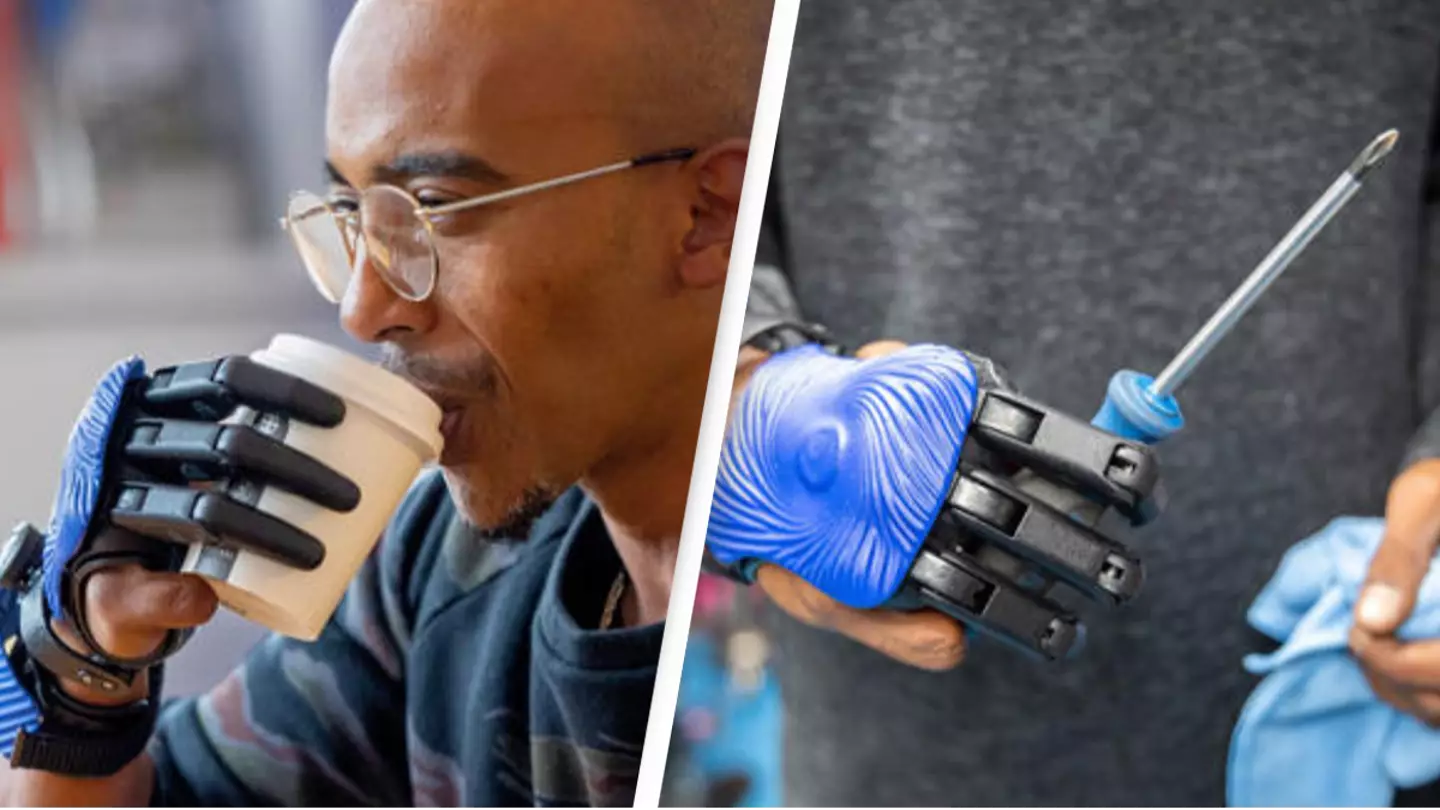Man whose hand was crushed by meat grinder becomes first person to get 3D-printed bionic fingers
