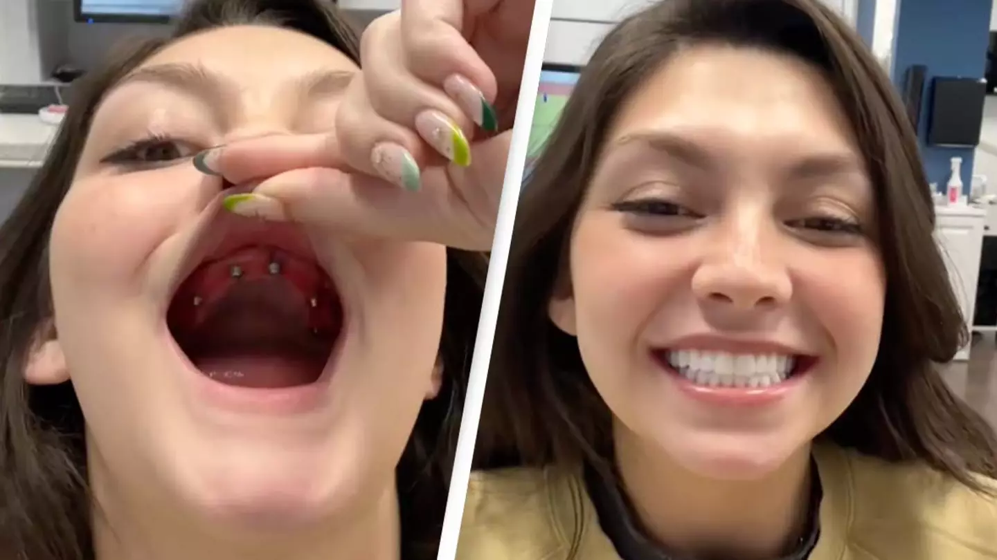 Woman shows incredible process of getting 'new teeth' that's leaving people in tears