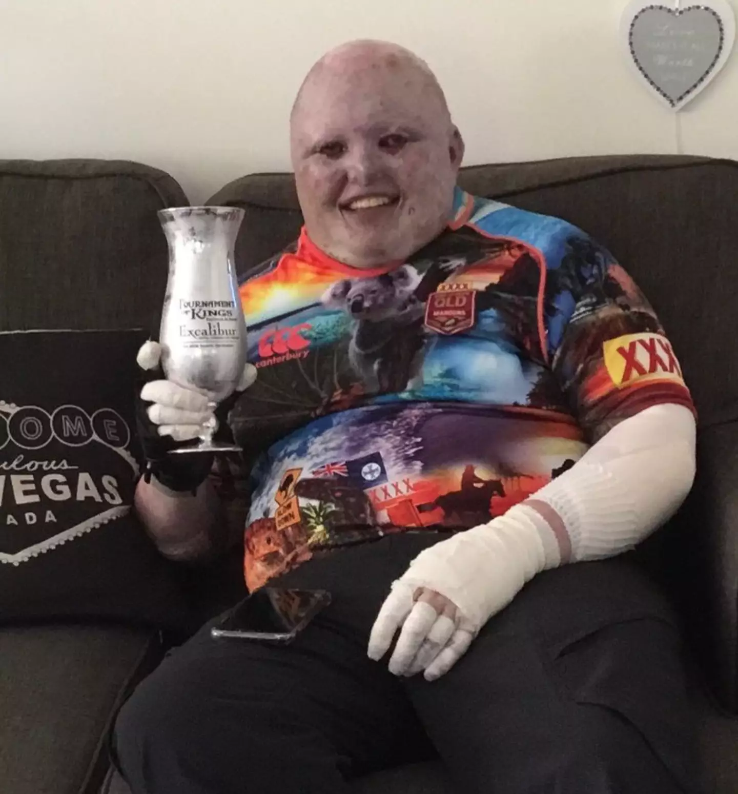 Clifford has the most severe form of Epidermolysis Bullosa - a rare skin condition. (Instagram/itsdeanclifford)