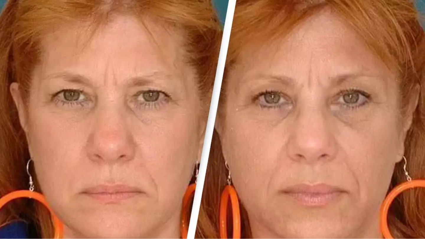 Identical twins reveal shocking difference in appearance after one divorced and the other was still married