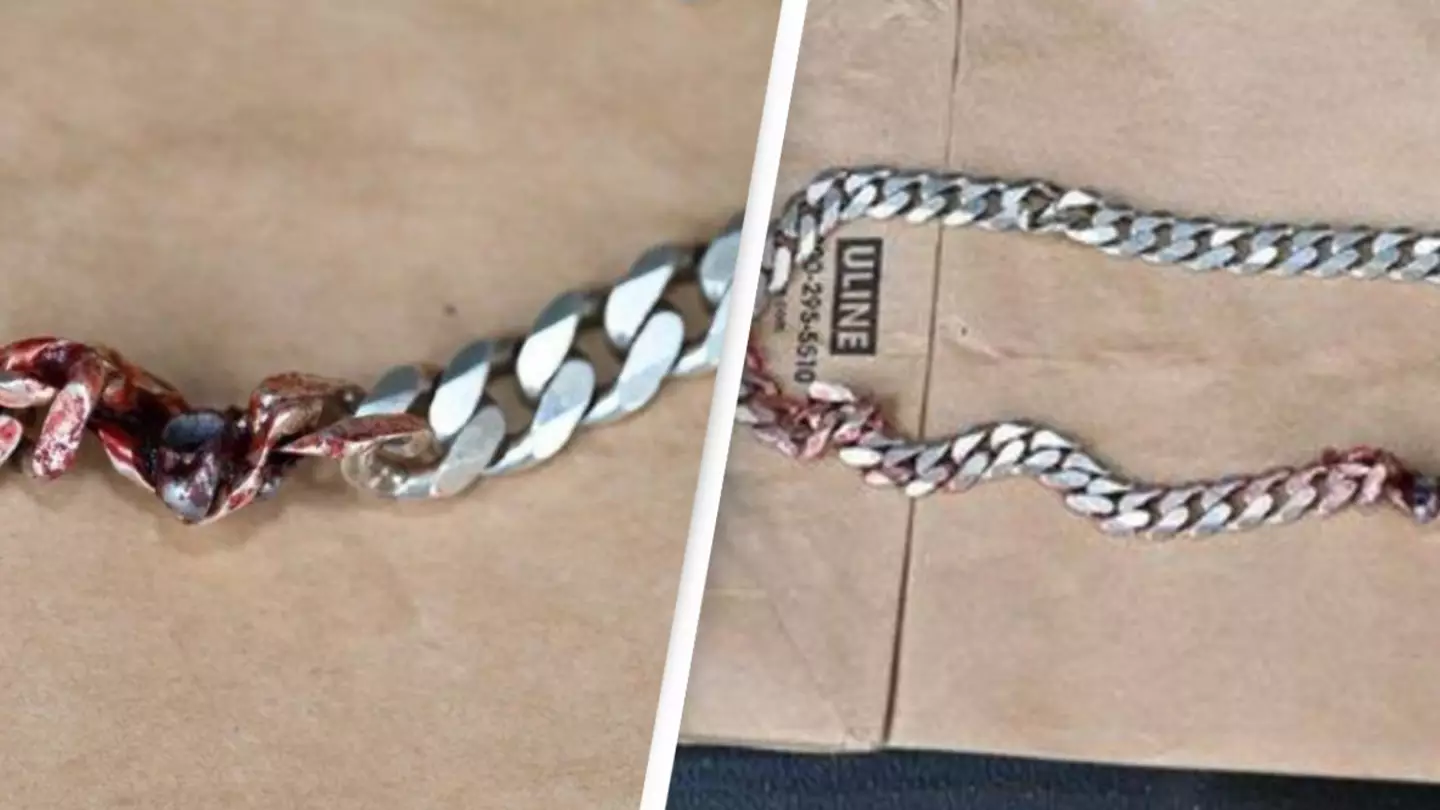Necklace saves man’s life from bullet that would 'have ended up' in his neck