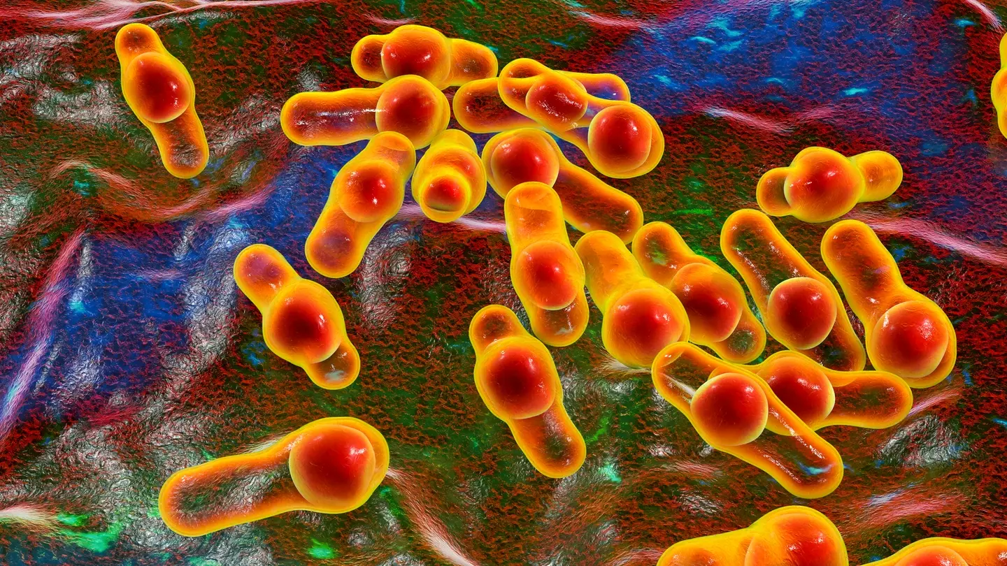 Foodborne botulism can be deadly if not treated (Kateryna Kon/Science Photo Library/Getty Images)