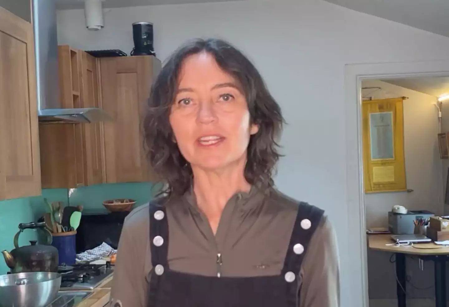 The condition affects one in 33 people. (Instagram/@eleanor.flegg)