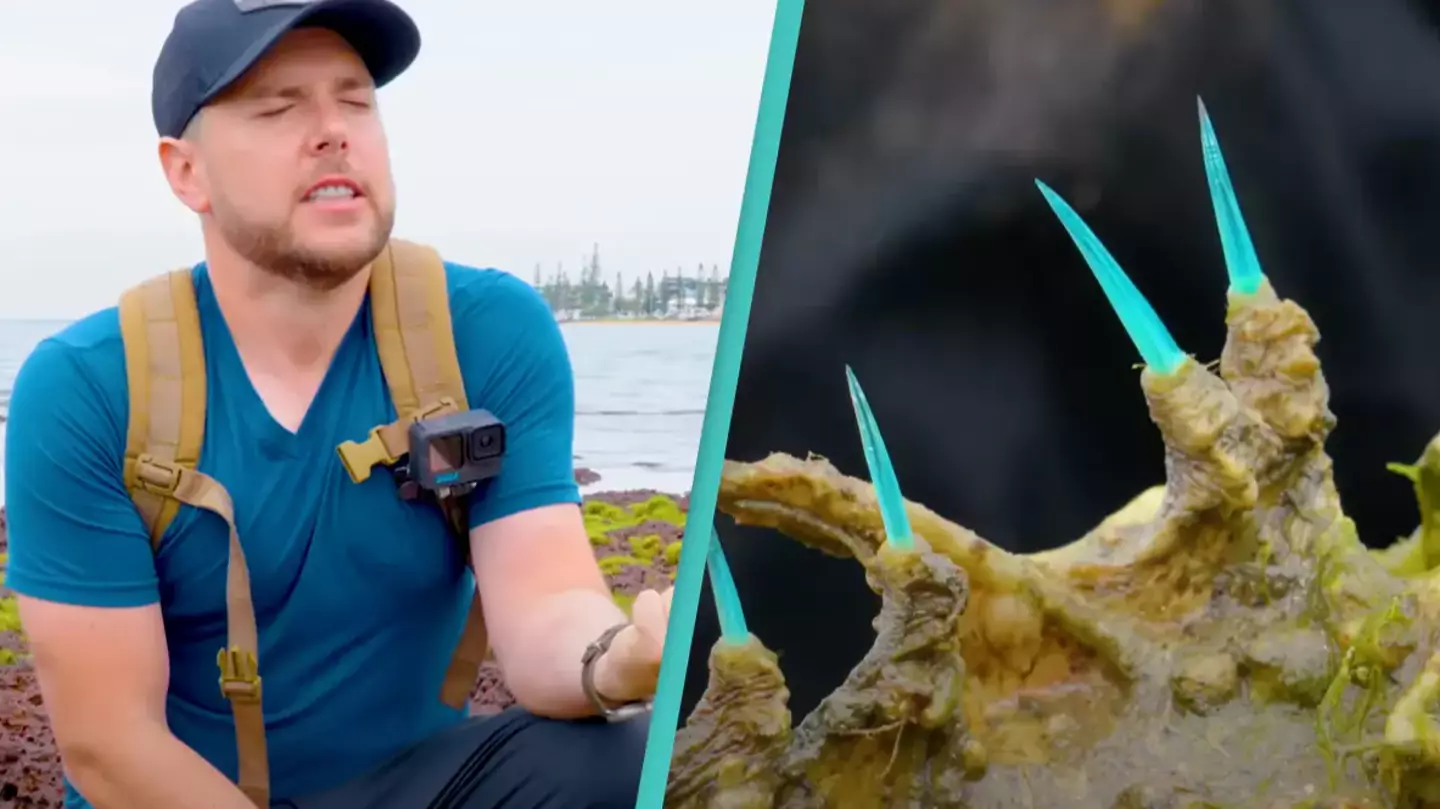 Man reveals what happens as he stings himself with 'most venomous fish in the world'
