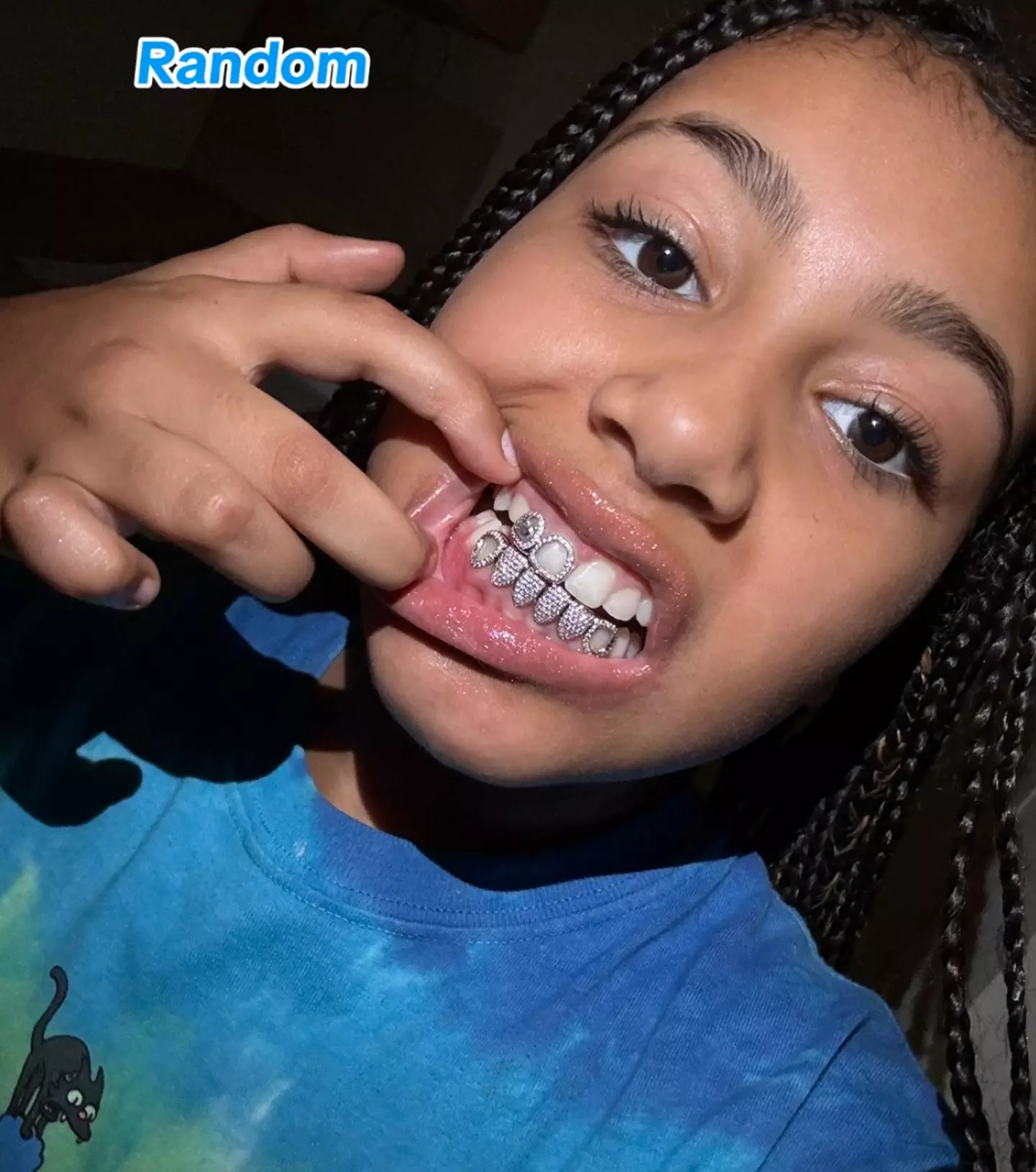North recently showed off her dental jewelry.