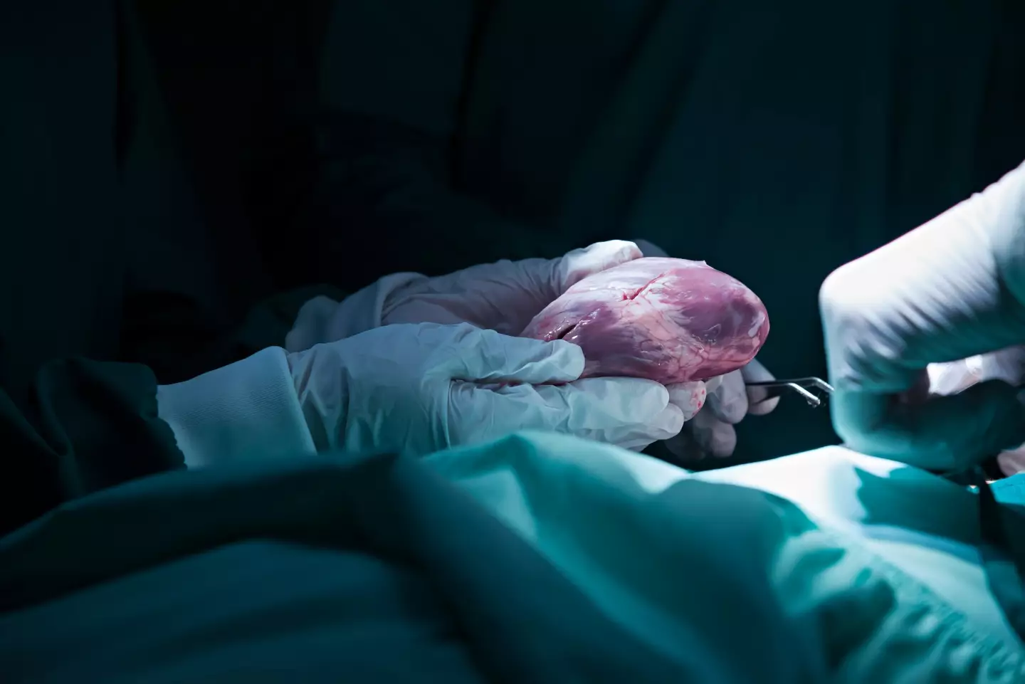 He had to wait a while for a heart transplant. (Getty Stock Photo)